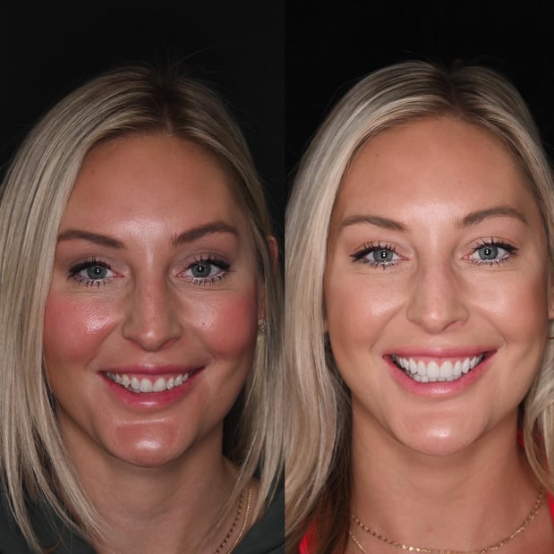 Images Nashville Wisdom Teeth and Implant Solutions