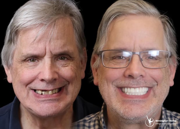 Images Birmingham Dental Implant Studio