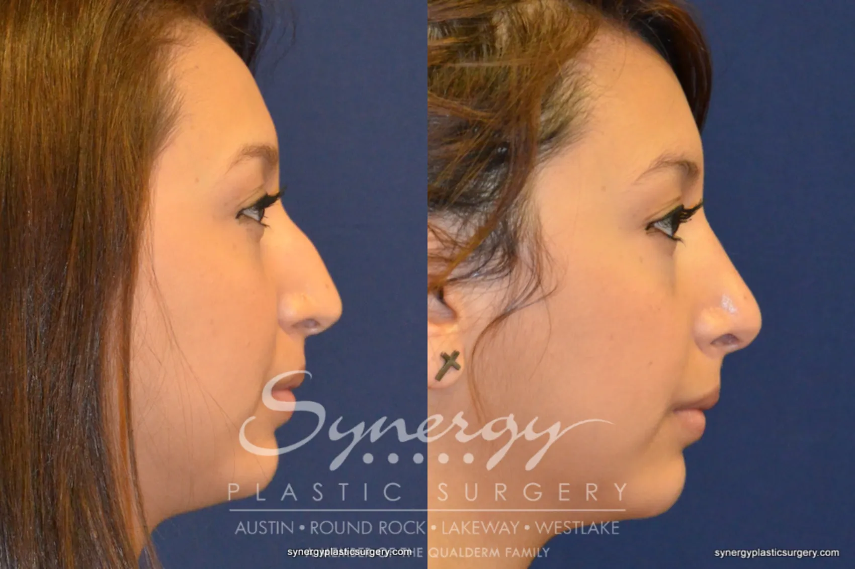 Synergy Plastic Surgery
