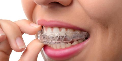 3 Invisalign Care Tips You Should Know Mark Stephens DMD Richmond (859)626-0069
