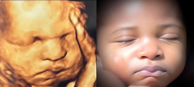 Images Chubby Cheeks 3D/4D Ultrasound Studio of Amarillo
