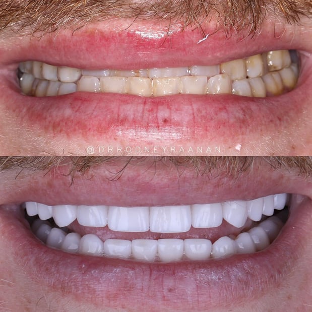 Images Dr. Rodney Raanan