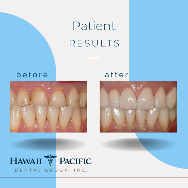 Images Hawaii Pacific Dental Group, Inc.