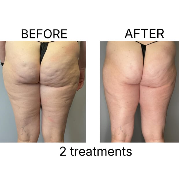 Images Sunkissed Med Spa