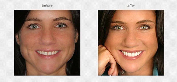 Images Hammond Aesthetic & General Dentistry