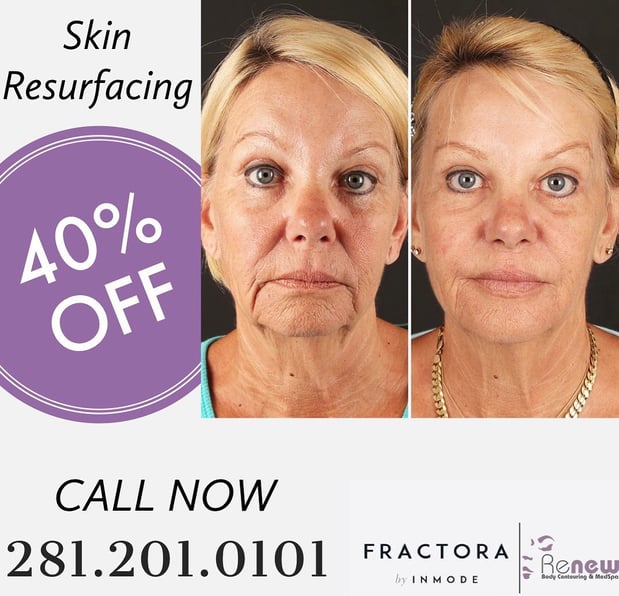 Images Renew Body Contouring & MedSpa