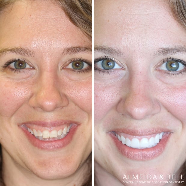 Images Almeida & Bell Dental Lone Tree - General, Cosmetic, and Implant Dentistry