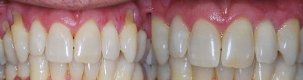 Images Mountainview Periodontics