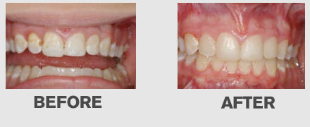 Images Cedar Ridge Esthetic and Family Dentistry