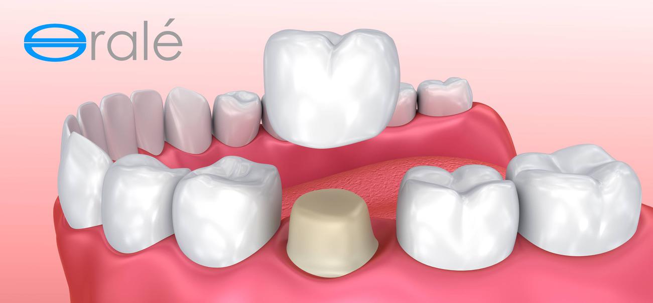 Blanchardstown Centre Dental Surgery (Orale Dental) 6