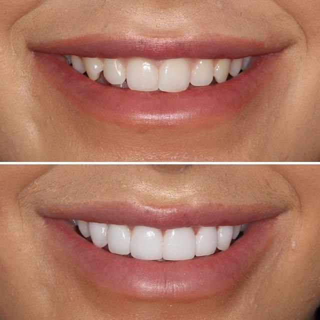 Images Smiles By Eddie: Dr. Edmond Ahdoot DDS