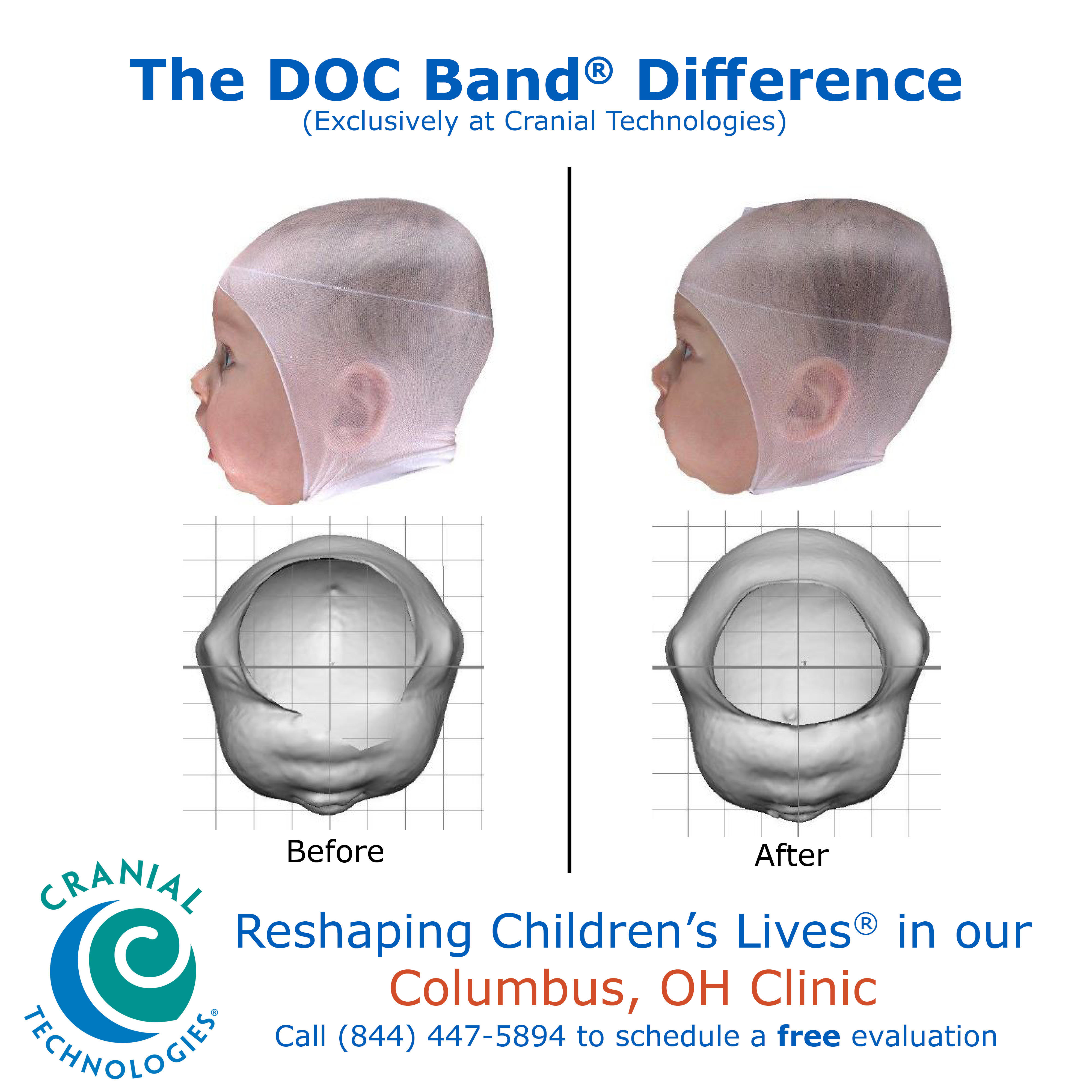 Cranial Technologies Photo