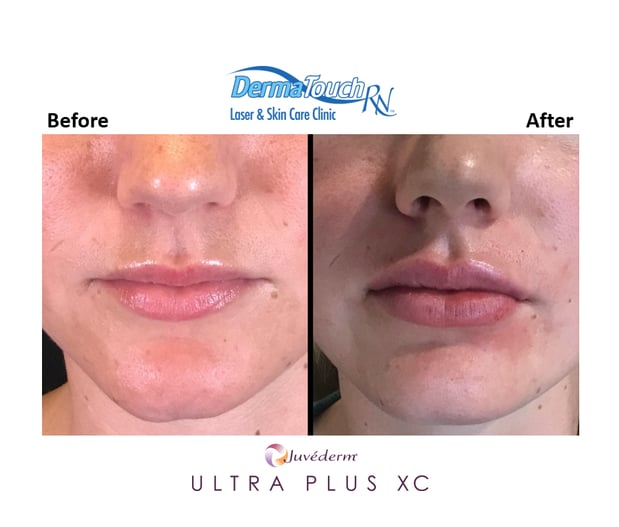 Images DermaTouch RN