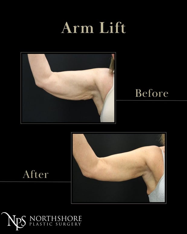 Images Northshore Plastic Surgery LLC