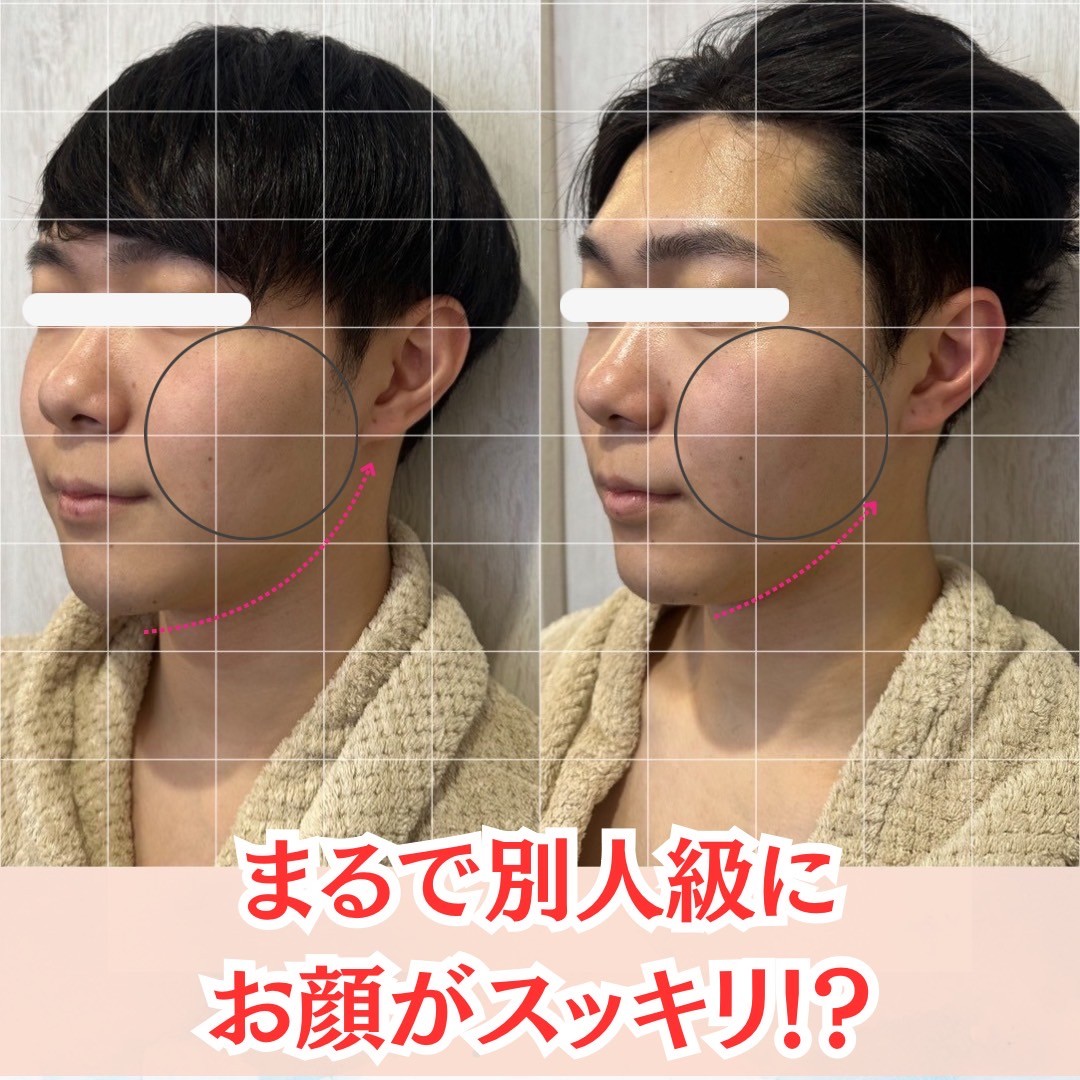 Images アディス リティフル
