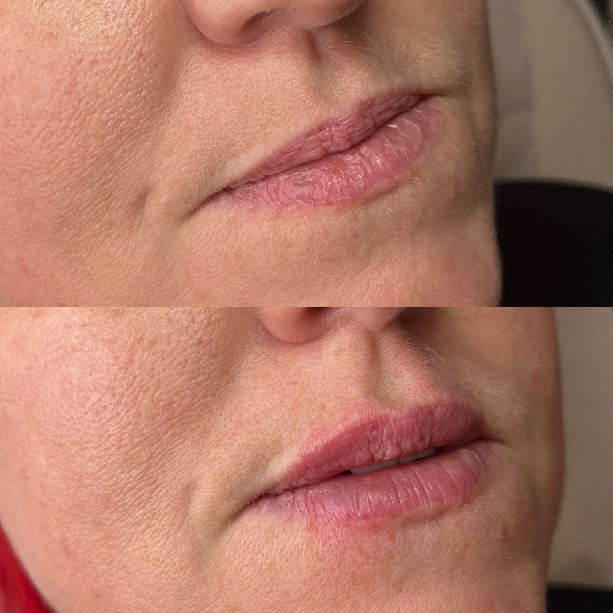 Images Harvey Medical Aesthetics