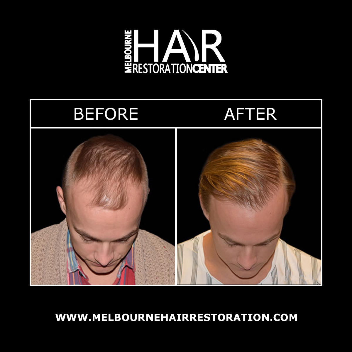 Melbourne Hair Restoration Center Image