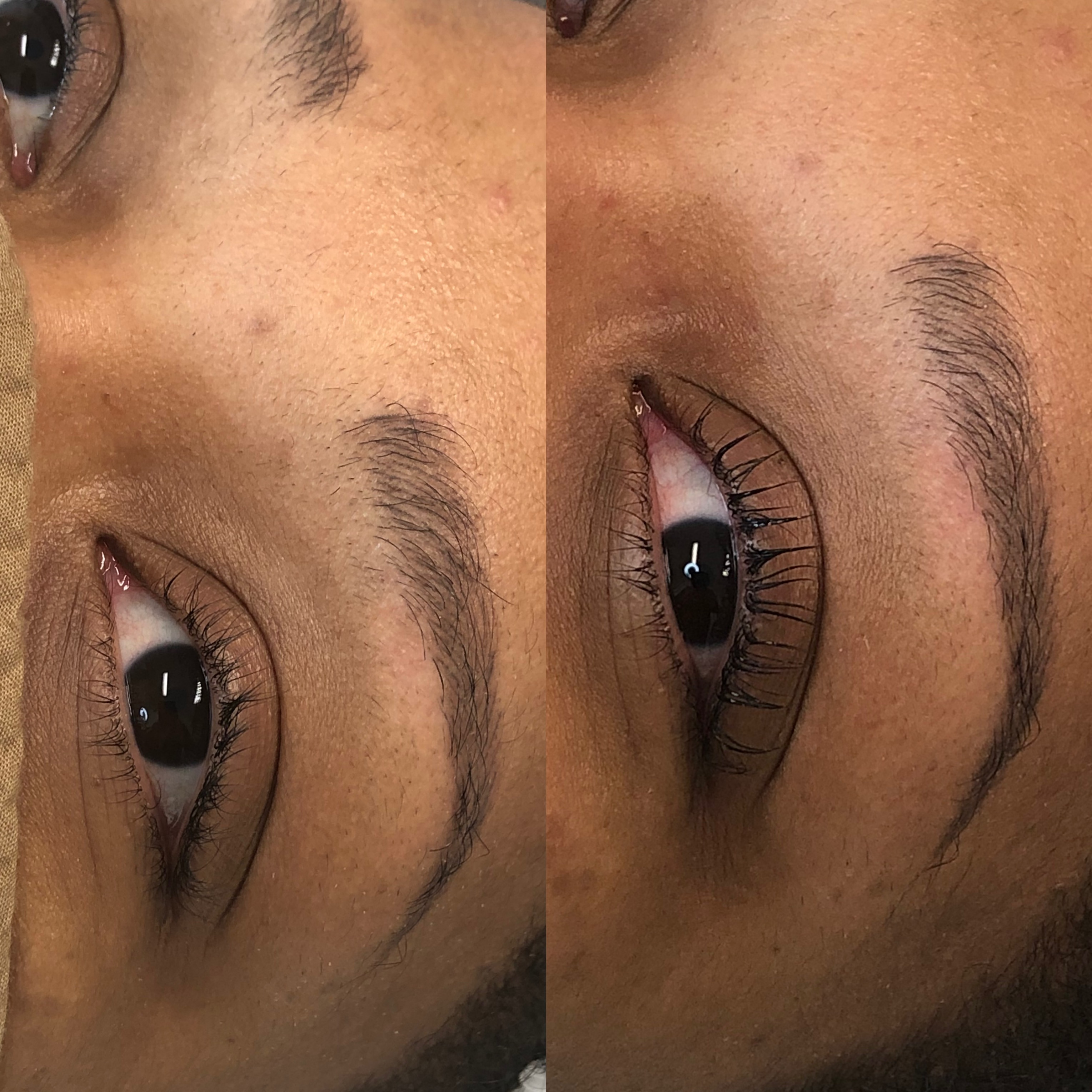 Images Clinique d'Esthétique Leila - Hydrafacial, Microblading, Épilation Laser Sainte-Foy