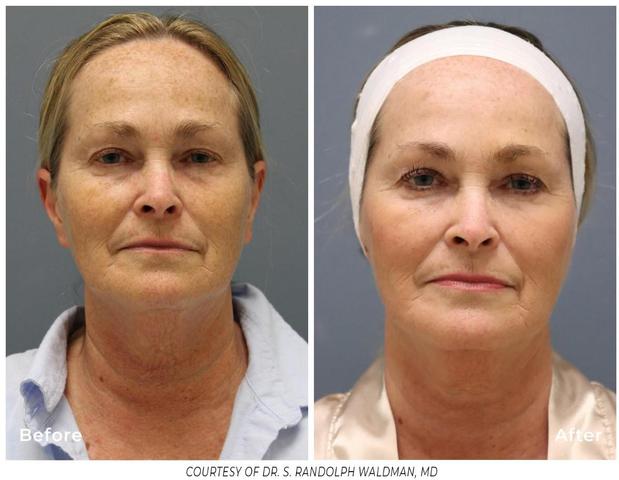 Images Tactus Health Aesthetics & Weight Loss Clinic