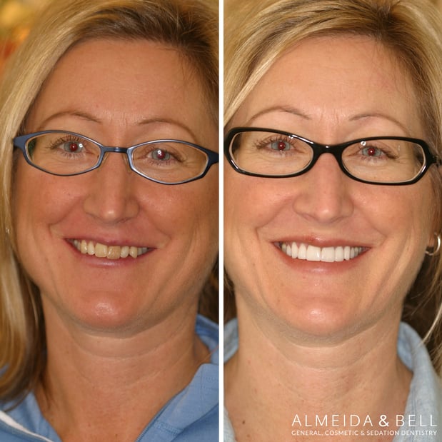 Images Almeida & Bell Dental Lone Tree - General, Cosmetic, and Implant Dentistry