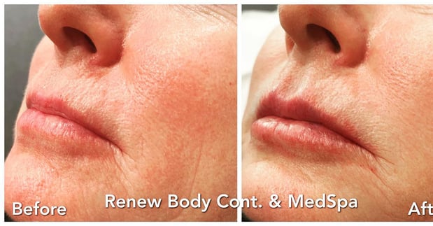Images Renew Body Contouring & MedSpa