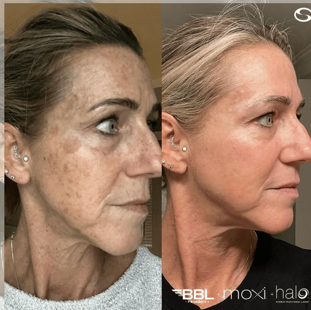 Images Serenity Aesthetics & Wellness