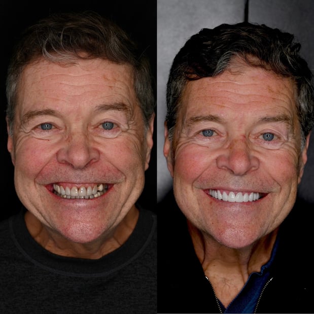 Images Nashville Wisdom Teeth and Implant Solutions