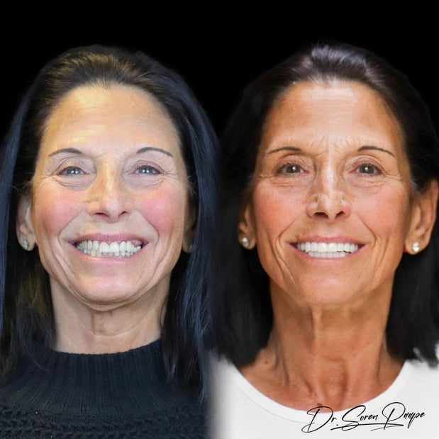 Images Smile Now Denver Dentures and Implants