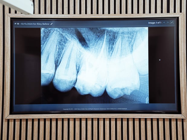 Images Dr Smilee Dental of Killeen, Family, Cosmetic, Implant, Medspa