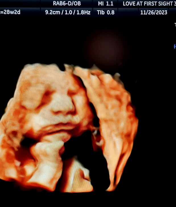 Images Love At First Sight 3D/4D Ultrasound Imaging Studio, LLC
