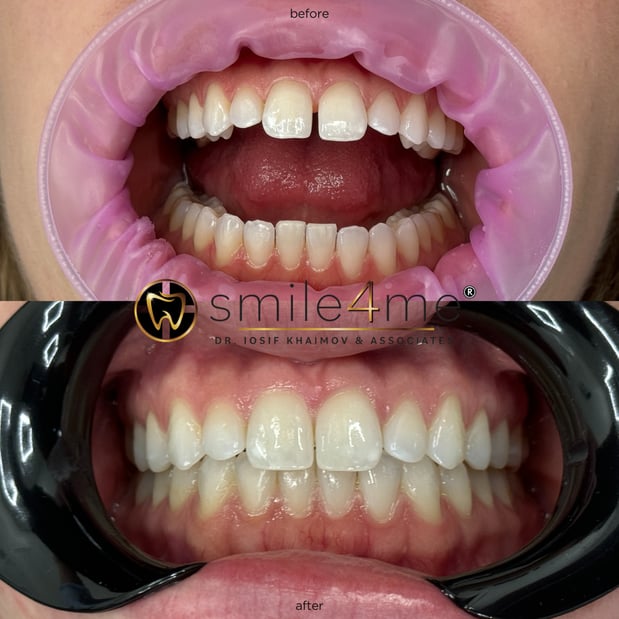 Images smile4me Dental Care - Astoria, Queens