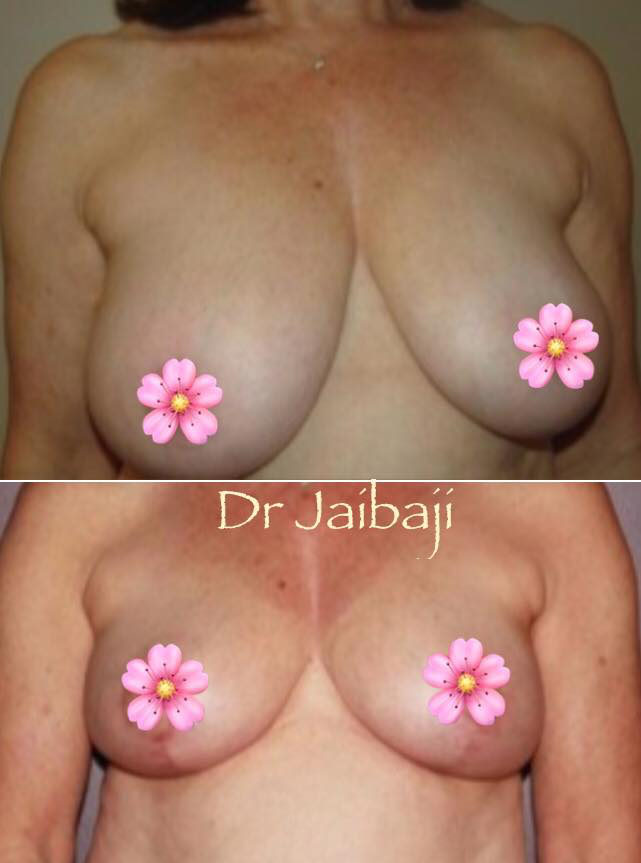 Jaibaji Plastic Surgery Photo