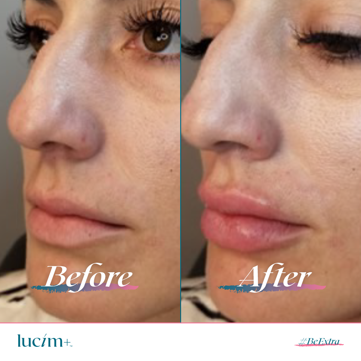 Gloss?repulpant pour les?lèvres Lucim+®