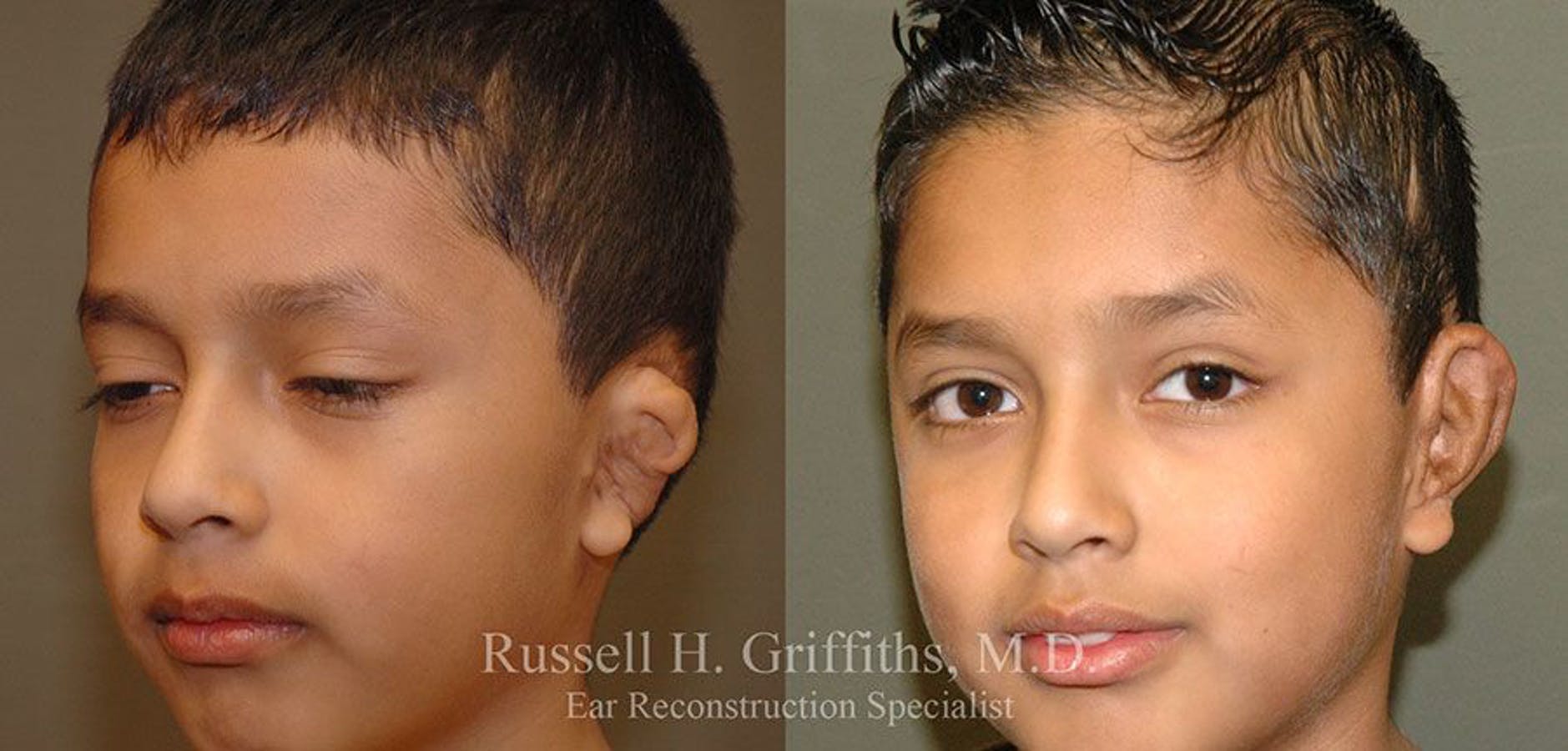 Results of Russell H. Griffiths, MD | Boise, ID