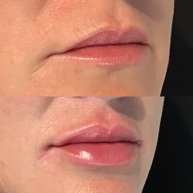Images BCRN Aesthetics MedSpa