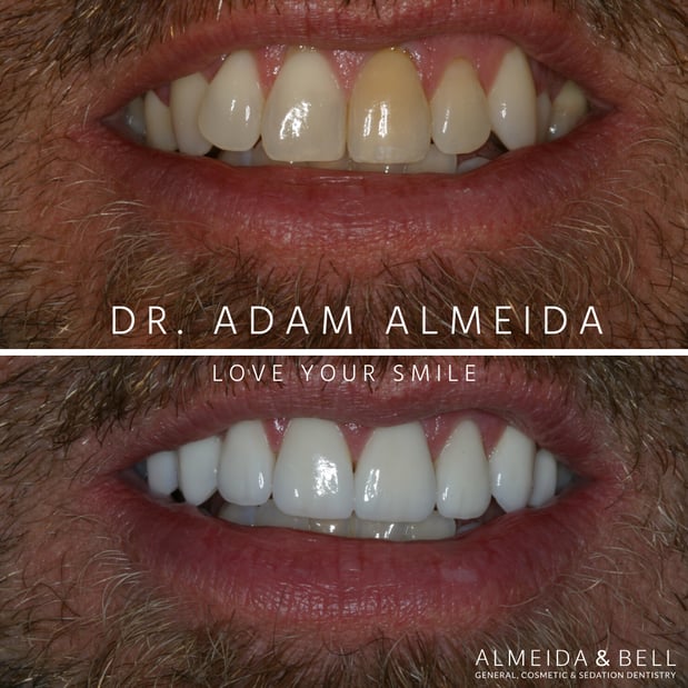 Images Almeida & Bell Dental Lone Tree - General, Cosmetic, and Implant Dentistry