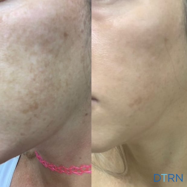 Images DermaTouch RN