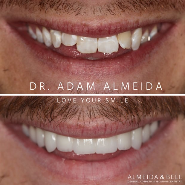 Images Almeida & Bell Dental Lone Tree - General, Cosmetic, and Implant Dentistry