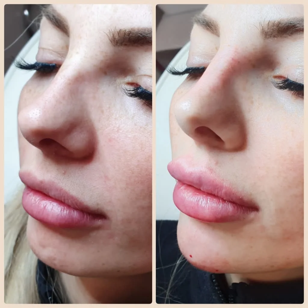 Images Lincoln Aesthetic