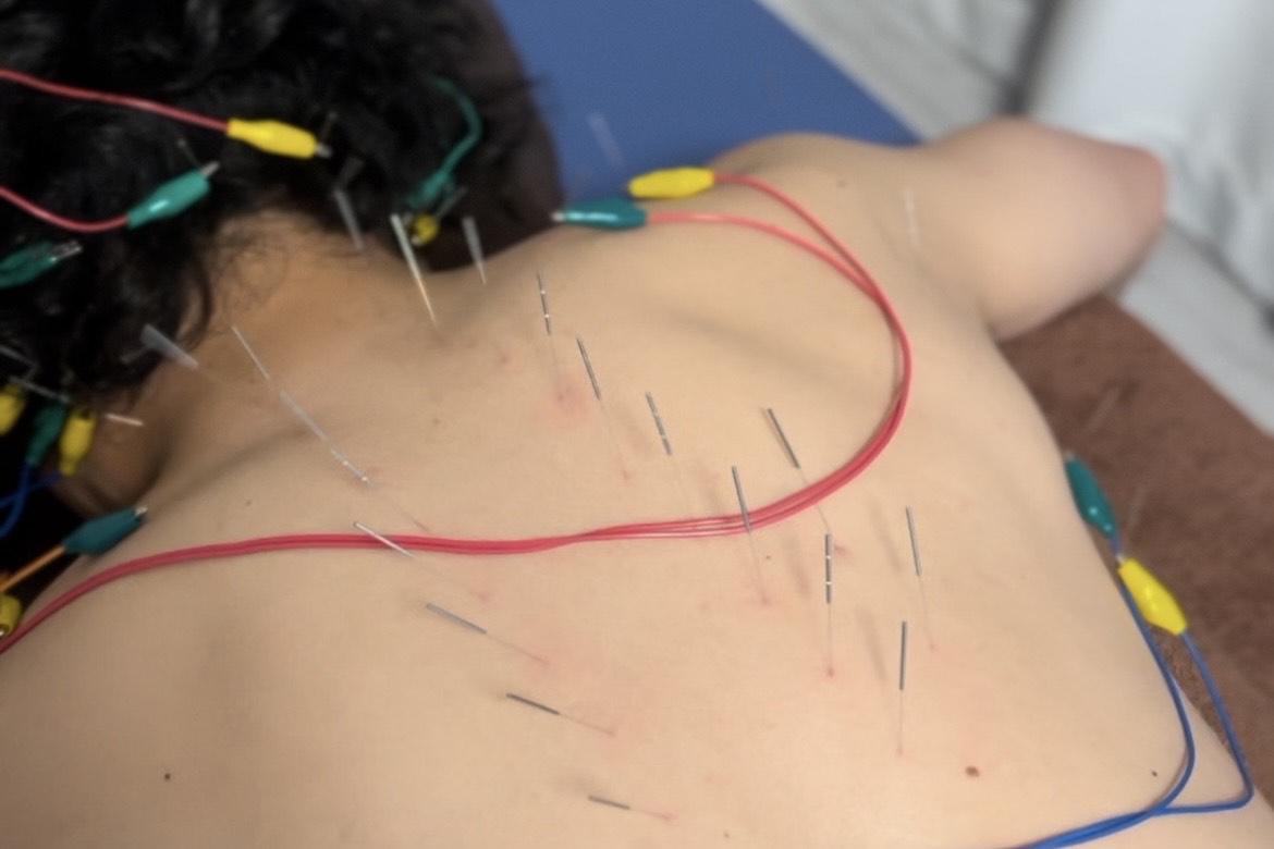 Images 鍼処MINAOSHI