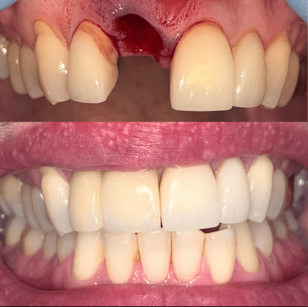 Images Mt. Pleasant Modern Dentistry