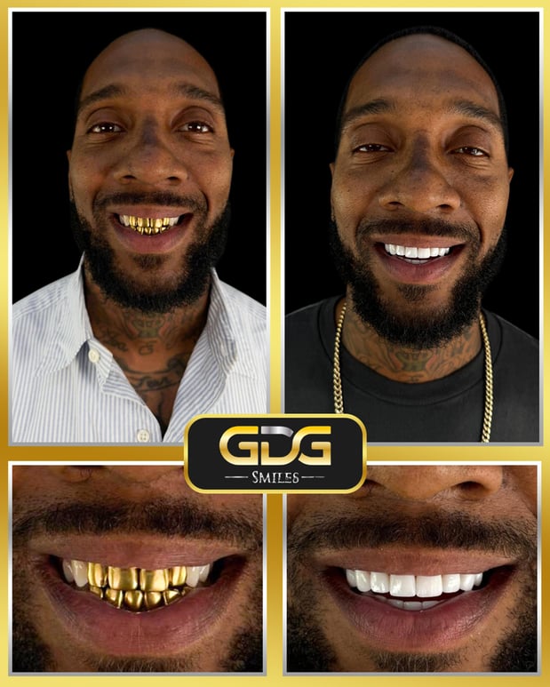 Images GDG Smiles