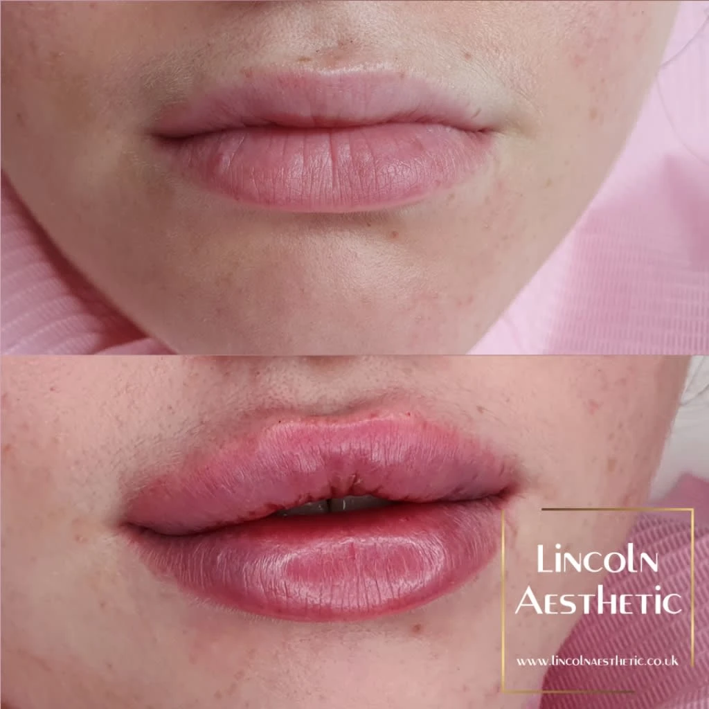 Images Lincoln Aesthetic