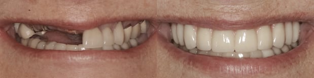 Images Iroquois Dentistry