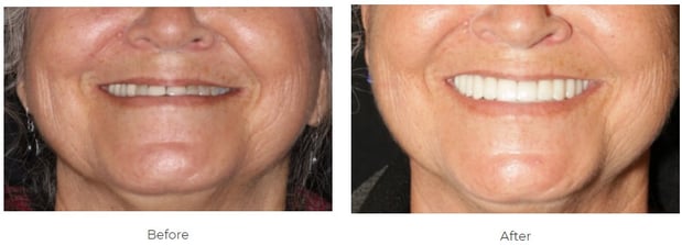 Images Aspen Ridge Dental