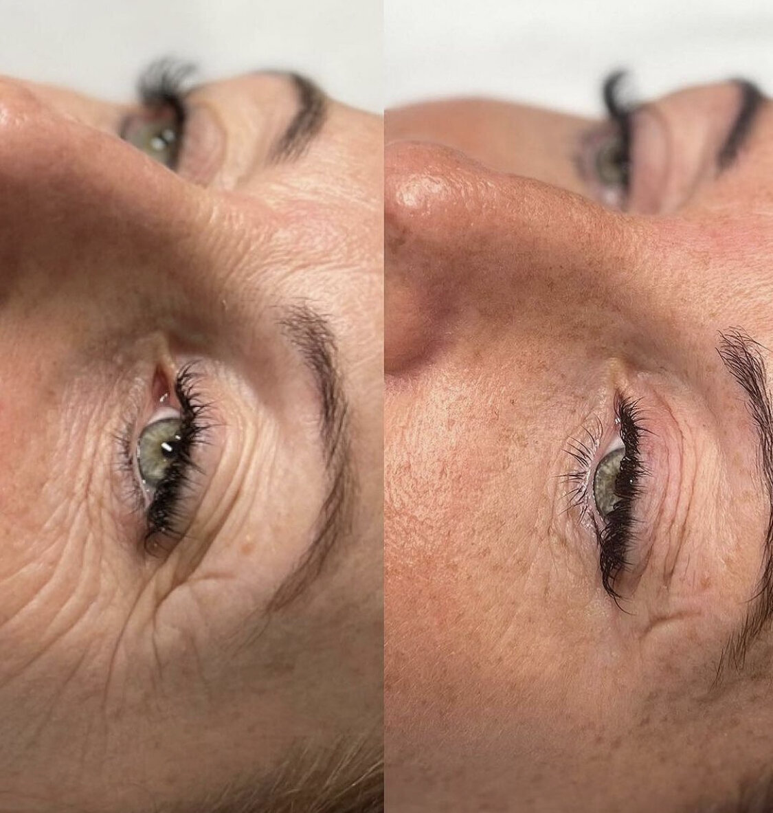 Images Harvey Medical Aesthetics