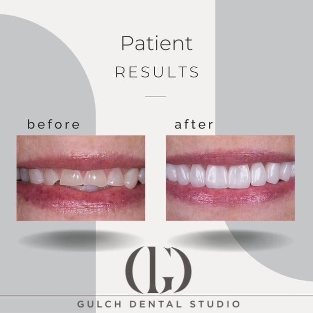 Images Gulch Dental Studio