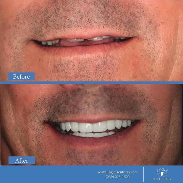 Images Engle Dentistry