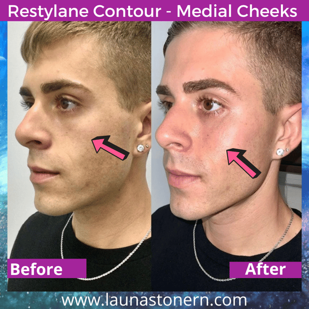 Images Launa Stone, R.N.