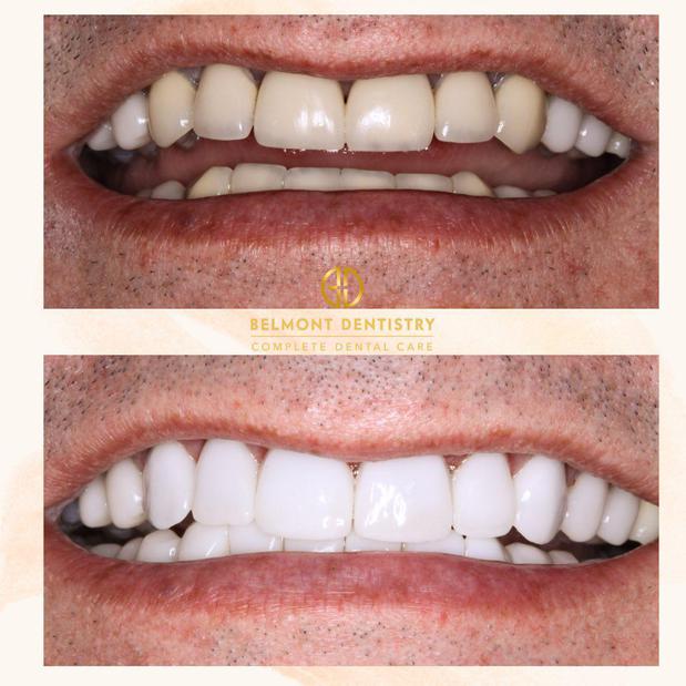 Images Belmont Dentistry Scottsdale